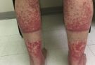 HT10. These are the consequences of sleeping with the…